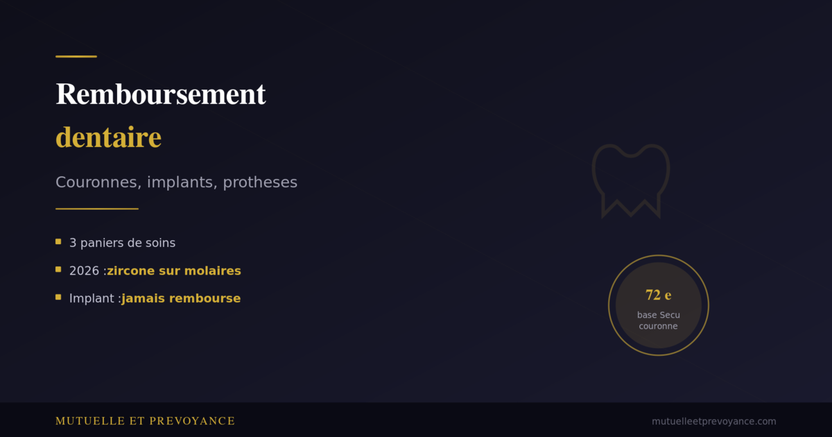 Remboursement dentaire mutuelle, couronnes implants protheses